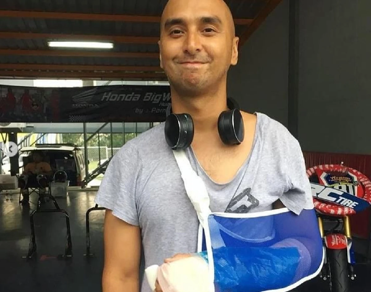 จอนนี่ อันวา เผยภาพนาทีระทึก! หลังเกิดอุบัติเหตุขณะแข่งมอเตอร์ไซค์