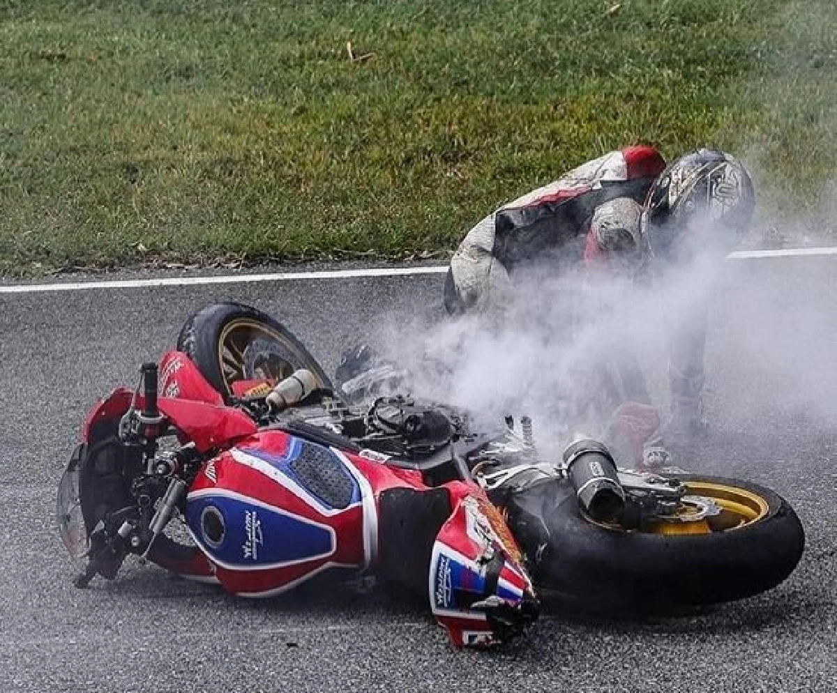 จอนนี่ อันวา เผยภาพนาทีระทึก! หลังเกิดอุบัติเหตุขณะแข่งมอเตอร์ไซค์