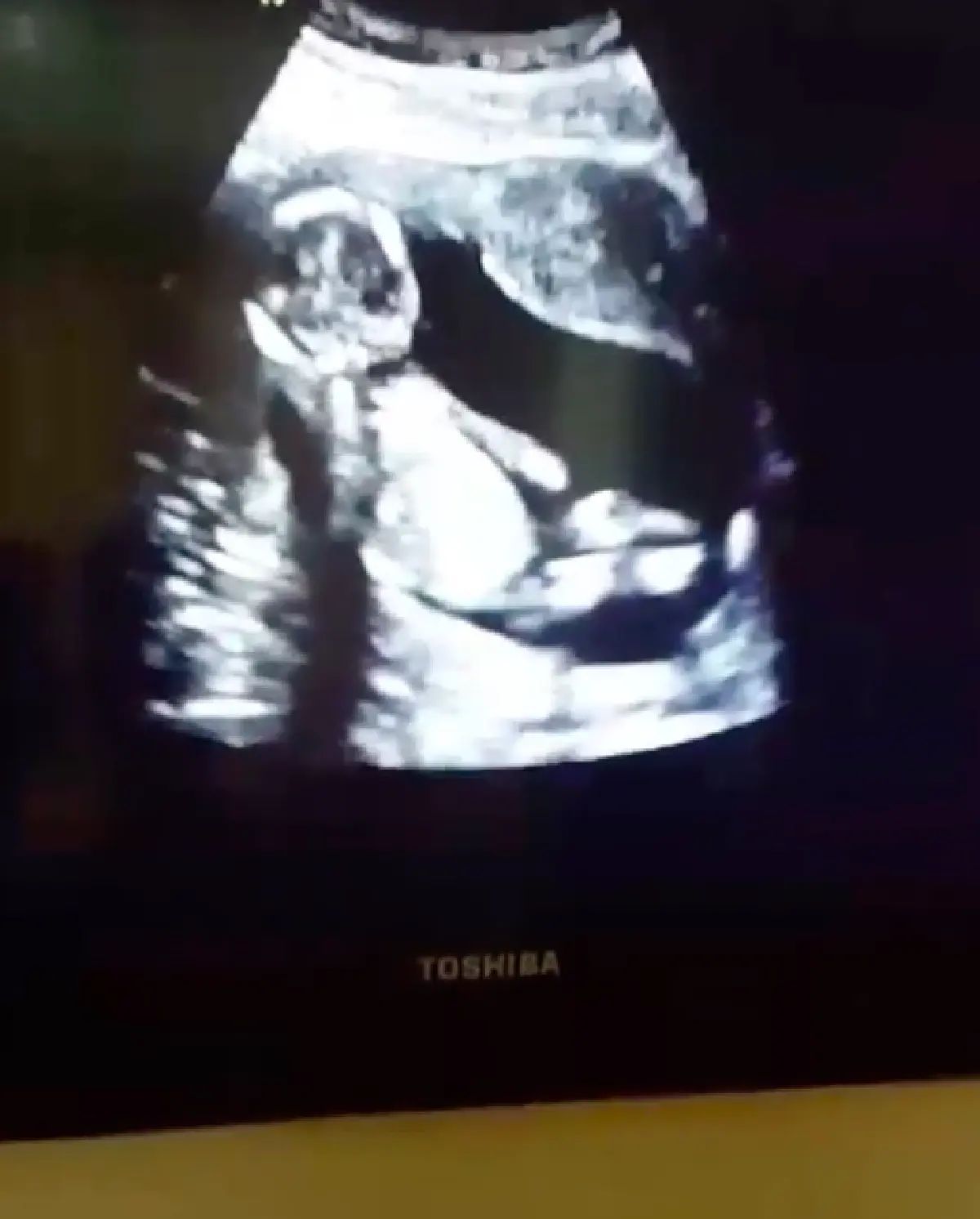 ดั้งโด่งเหมือนพ่อ! "ศรราม" โชว์คลิปอัลตร้าซาวด์ลูกสาว "น้องวีจิ”