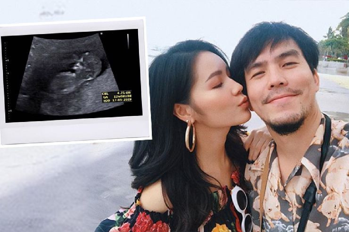 “ดีเจเผือก” แฮปปี้หนักมาก!! ภรรยาสาว “ลูกจ๋า” ตั้งครรภ์แล้ว “ดีเจเผือก” แฮปปี้หนักมาก!! ภรรยาสาว “ลูกจ๋า” ตั้งครรภ์แล้ว