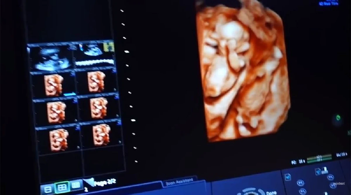 โชคสองชั้น! ป๊อก-มาร์กี้ เฉลยเพศลูกในครรภ์..ได้แฝดชายหญิงสมใจ