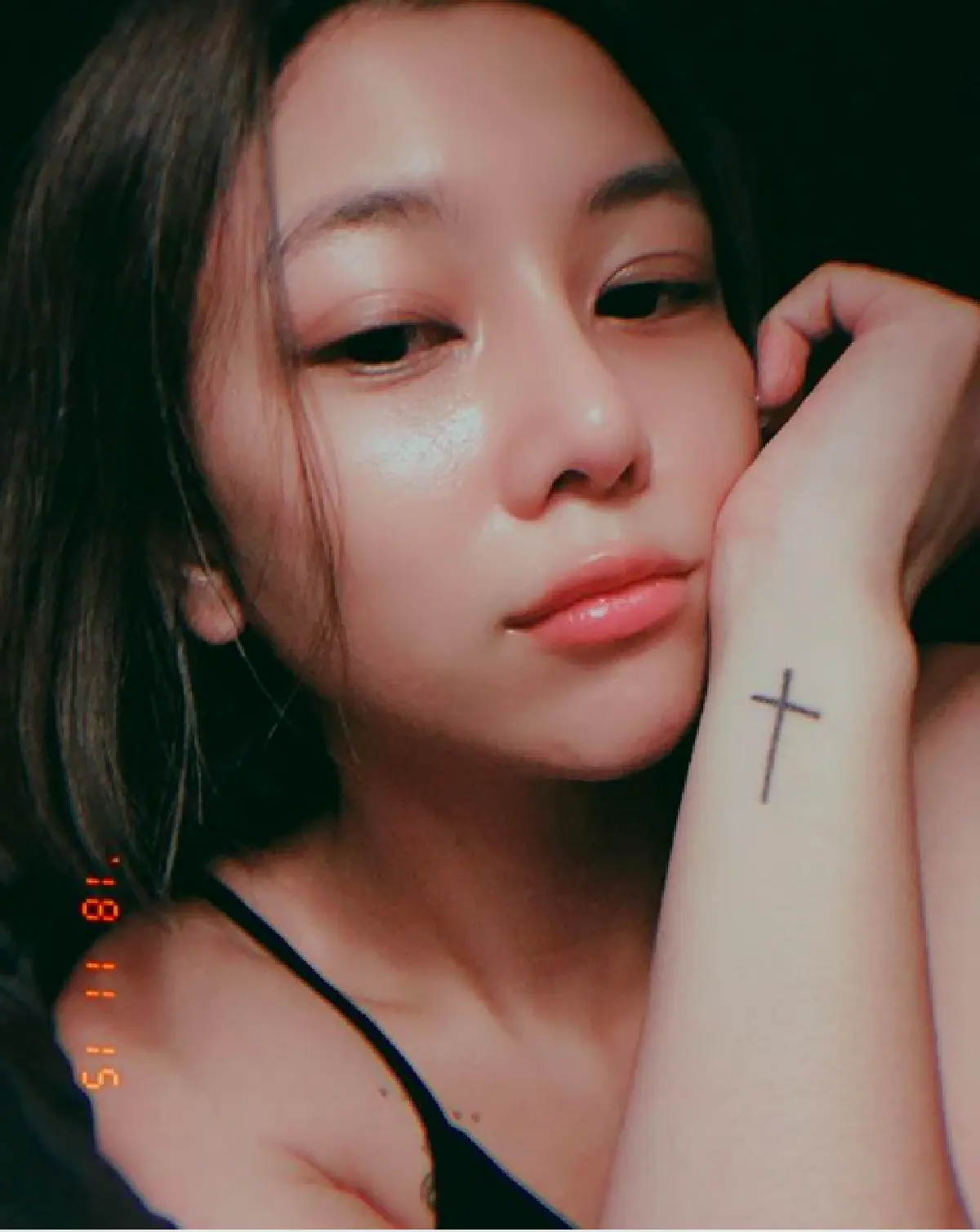 ผ่านไป 1 เดือน "กุ๊บกิ๊บ” กับดั้งใหม่ ที่ทำให้ดูสวยขึ้นและหน้าเด็กลง