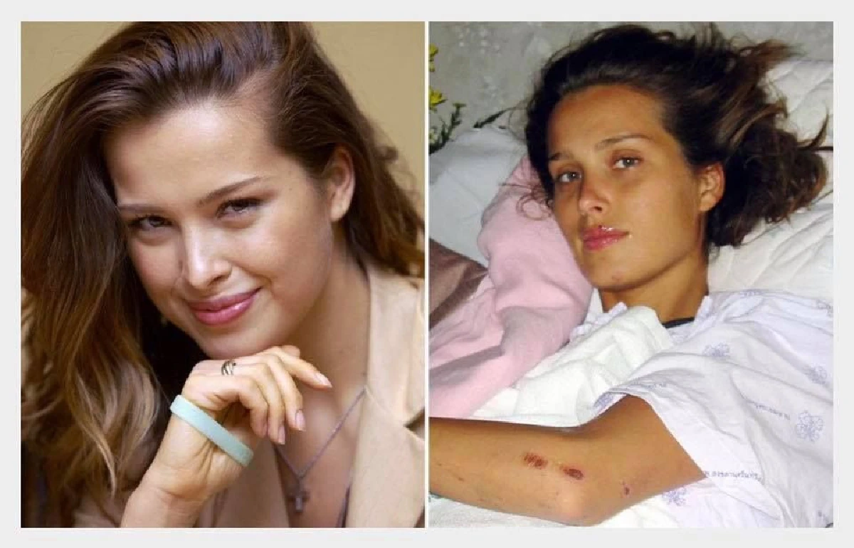 "เรื่องเล่าจากหมอ" 20วันของการรักษา "เพทรา เนมโควา" นางแบบดังระดับโลกผู้ประสบภัยสึนามิ