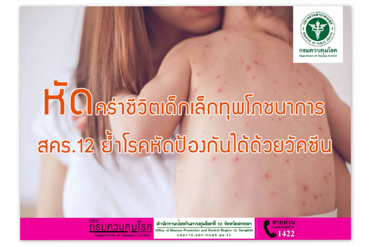 โรคหัดระบาด4จังหวัดใต้เด็กเล็กตาย18ศพหมอยันป้องกันได้ โรคหัดระบาด4จังหวัดใต้เด็กเล็กตาย18ศพหมอยันป้องกันได้