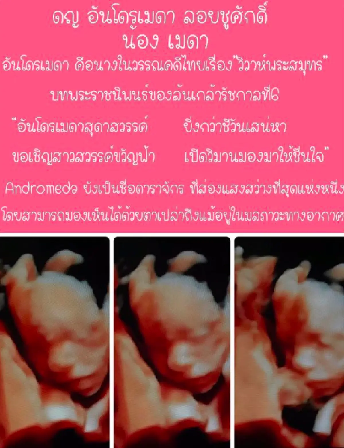 “เจมส์-ก้อย” เผยชื่อลูกสาว "น้องเมดา ด.ญ.อันโดรเมดา" ตั้งตามชื่อในวรรณคดีไทย