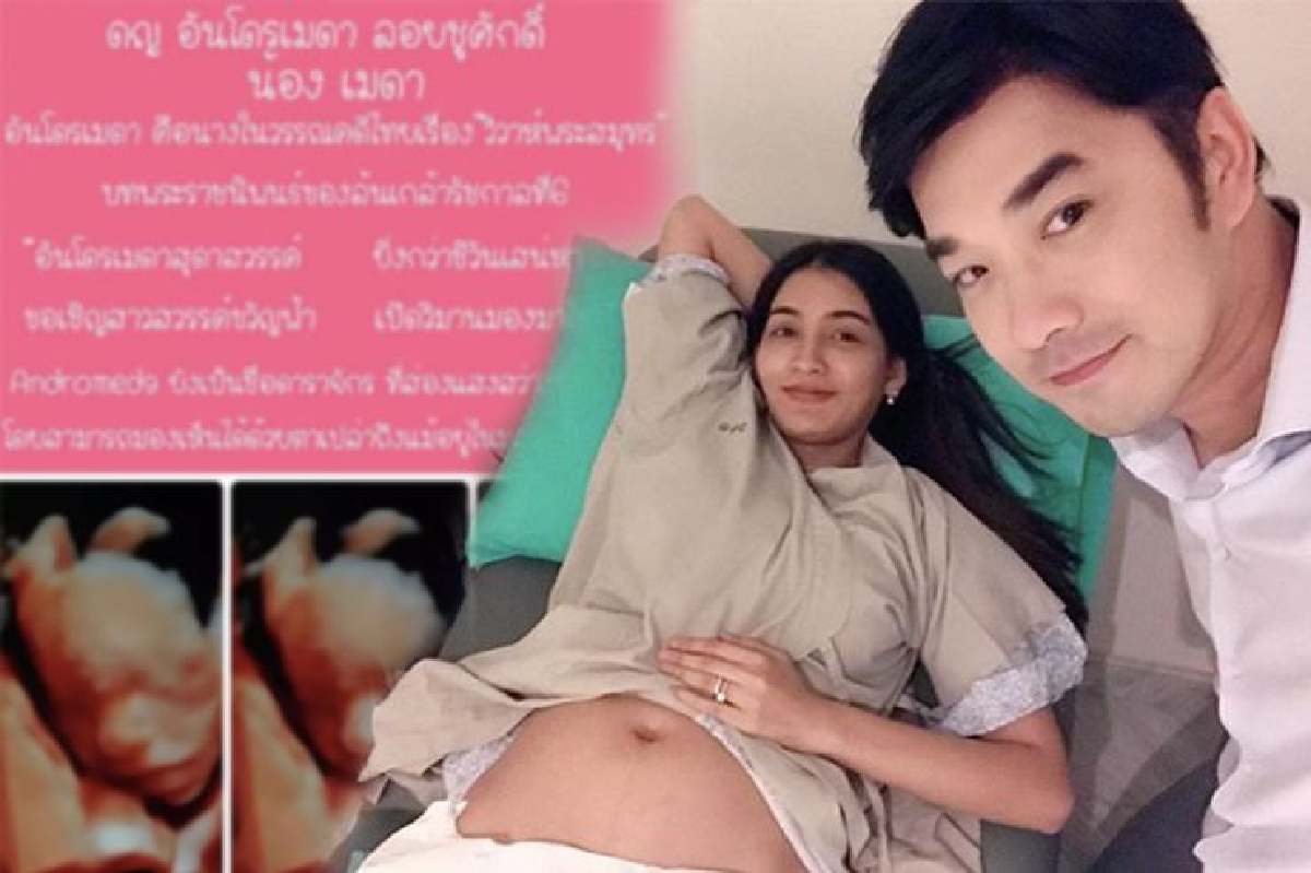 “เจมส์-ก้อย” เผยชื่อลูกสาว "น้องเมดา ด.ญ.อันโดรเมดา" ตั้งตามชื่อในวรรณคดีไทย “เจมส์-ก้อย” เผยชื่อลูกสาว "น้องเมดา ด.ญ.อันโดรเมดา" ตั้งตามชื่อในวรรณคดีไทย