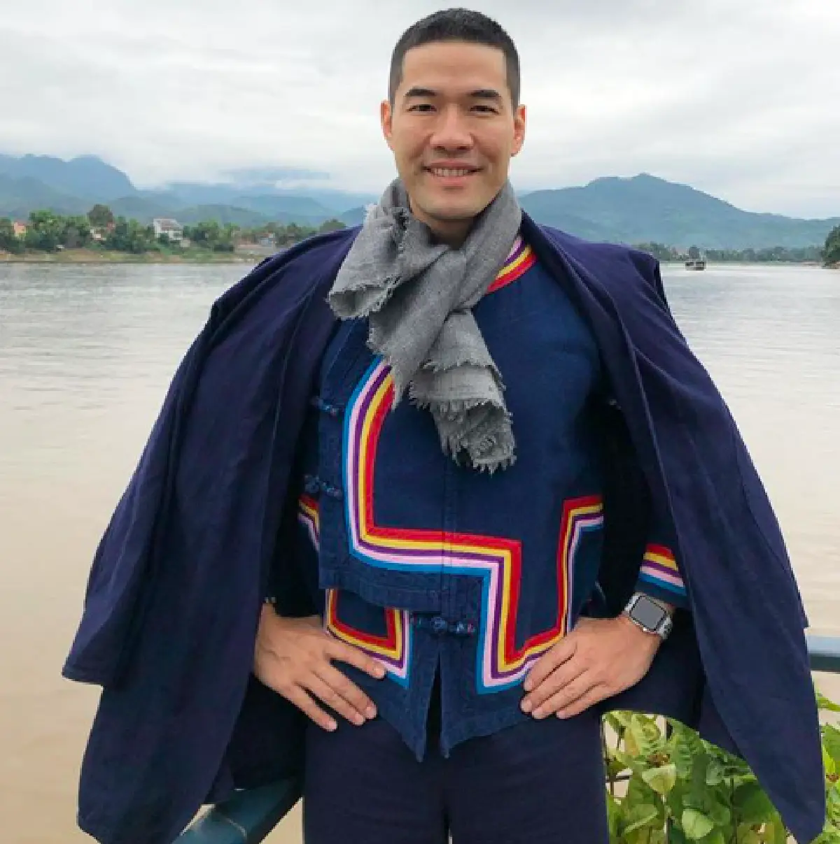 ทีมแพทย์ส่งเครื่องบินรับ “วู้ดดี้” กลับไทยด่วน หลังเกิดจากอุบัติเหตุจักรยานล้ม