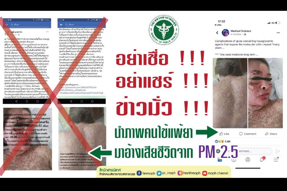 สธ.เตือน "อย่าเชื่อ-อย่าแชร์" ข่าวปลอมอ้างมีคนตายจากฝุ่นPM2.5 สธ.เตือน "อย่าเชื่อ-อย่าแชร์" ข่าวปลอมอ้างมีคนตายจากฝุ่นPM2.5