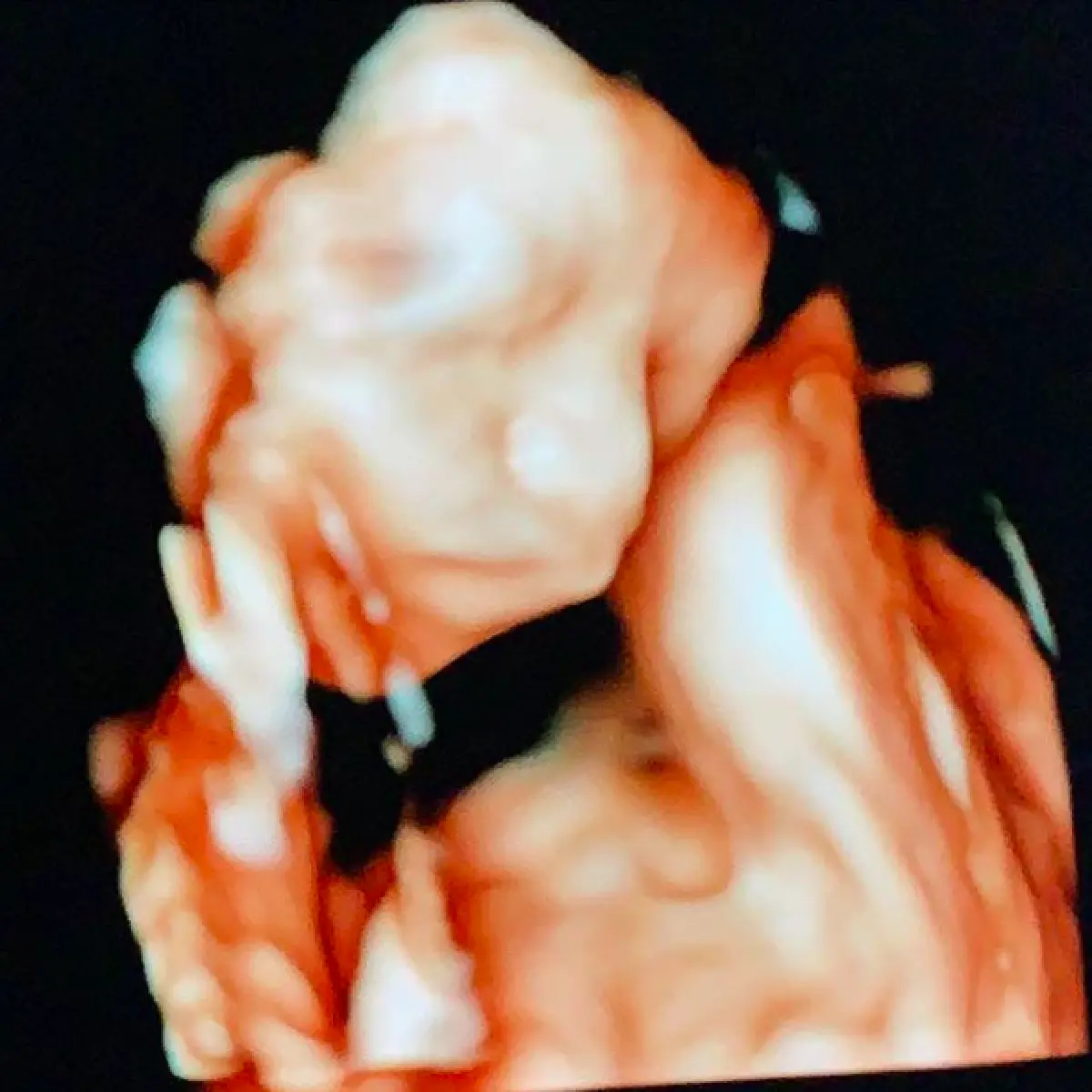 ดั้งโด่งมาแต่ไกล “แม่บุ้ง-พ่อเวฟ” เผยภาพอัลตราซาวด์ลูกชาย “น้องบุญ” หล่อเหมือนพ่อ