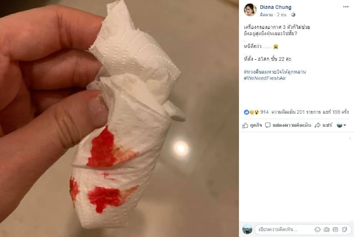 สุขภาพเริ่มย่ำแย่! ได๋ ไดอาน่า แพ้ฝุ่นพิษย่านอโศกจนเลือดออกจมูก