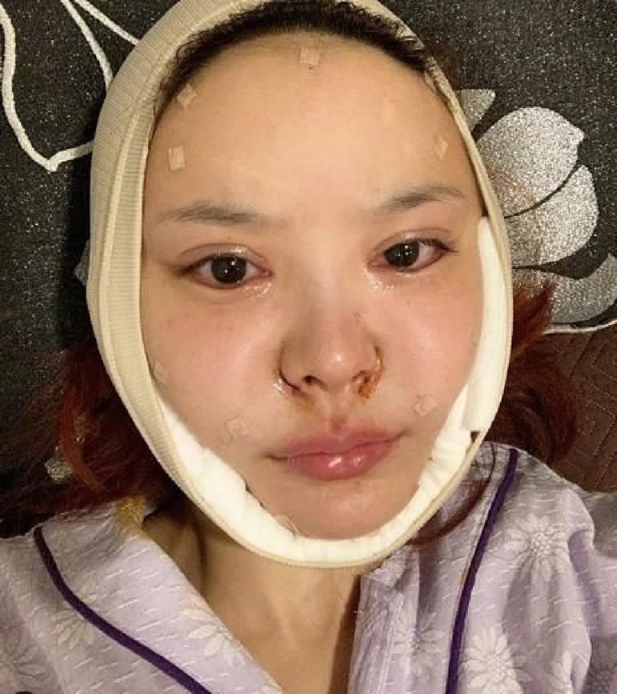 ไม่หยุดสวย! หญิงแย้ เผยหน้าบวมเป่ง..บินเกาหลีอัพหน้าใหม่อีกแล้ว (คลิป)