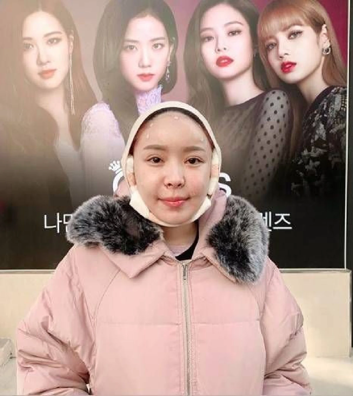 ไม่หยุดสวย! หญิงแย้ เผยหน้าบวมเป่ง..บินเกาหลีอัพหน้าใหม่อีกแล้ว (คลิป)