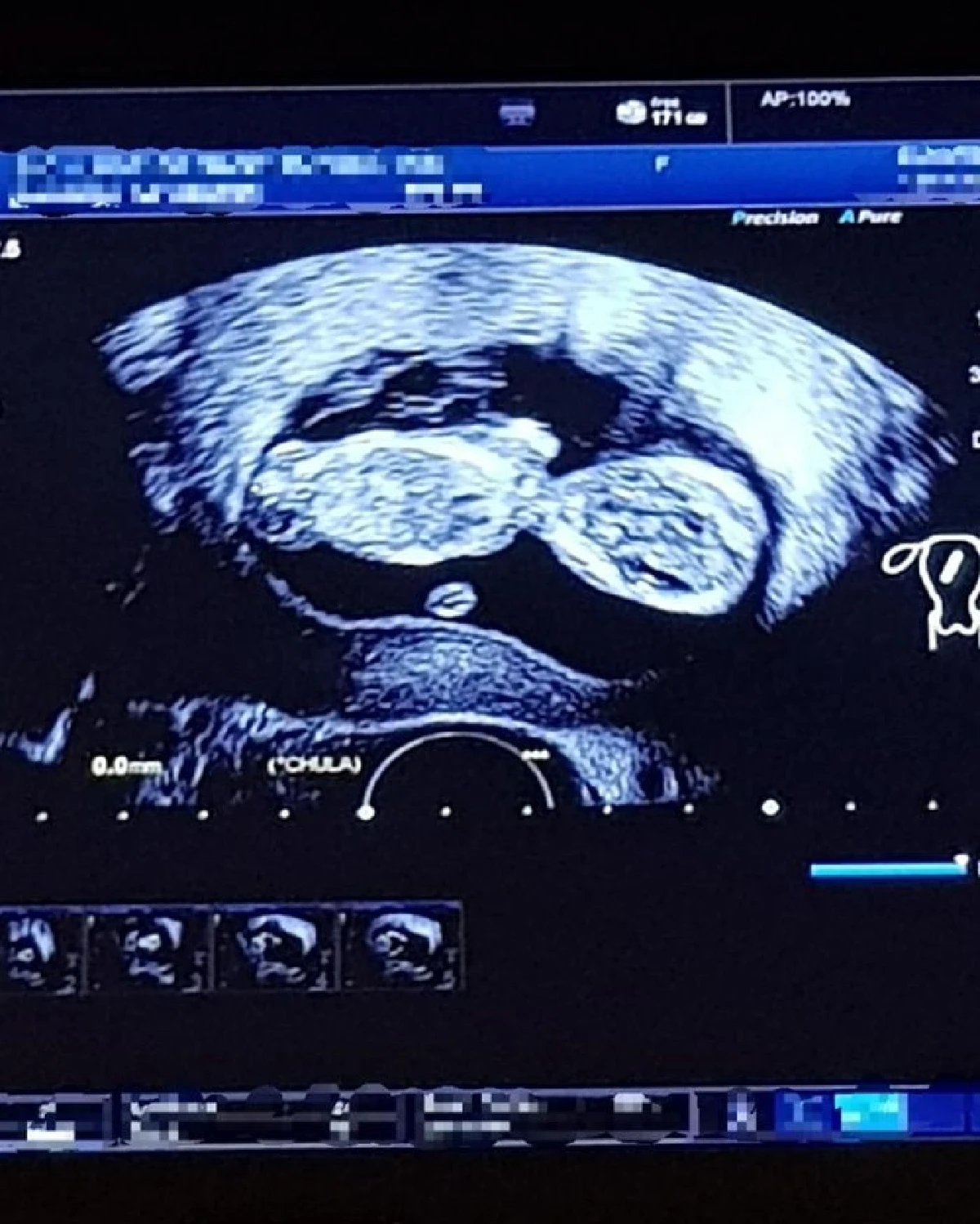 “แนนซี่” อดีตนักร้องดังยุค 90 คู่ดูโอ้ "ราฟฟี่-แนนซี่” เผยข่าวดีกำลังเป็นว่าที่คุณแม่