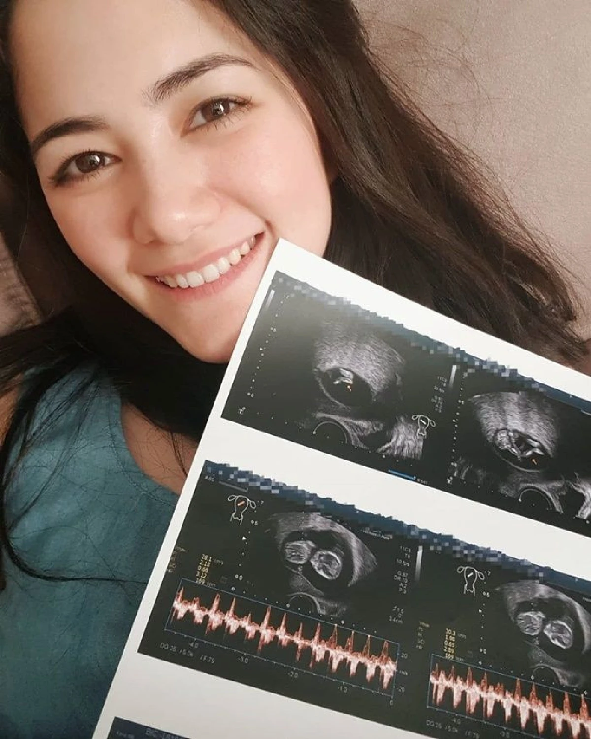 “แนนซี่” อดีตนักร้องดังยุค 90 คู่ดูโอ้ "ราฟฟี่-แนนซี่” เผยข่าวดีกำลังเป็นว่าที่คุณแม่