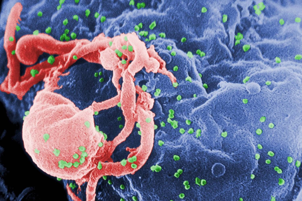 โลกปลอด HIV รายที่สอง จุดประกายความหวังใหม่ โลกปลอด HIV รายที่สอง จุดประกายความหวังใหม่