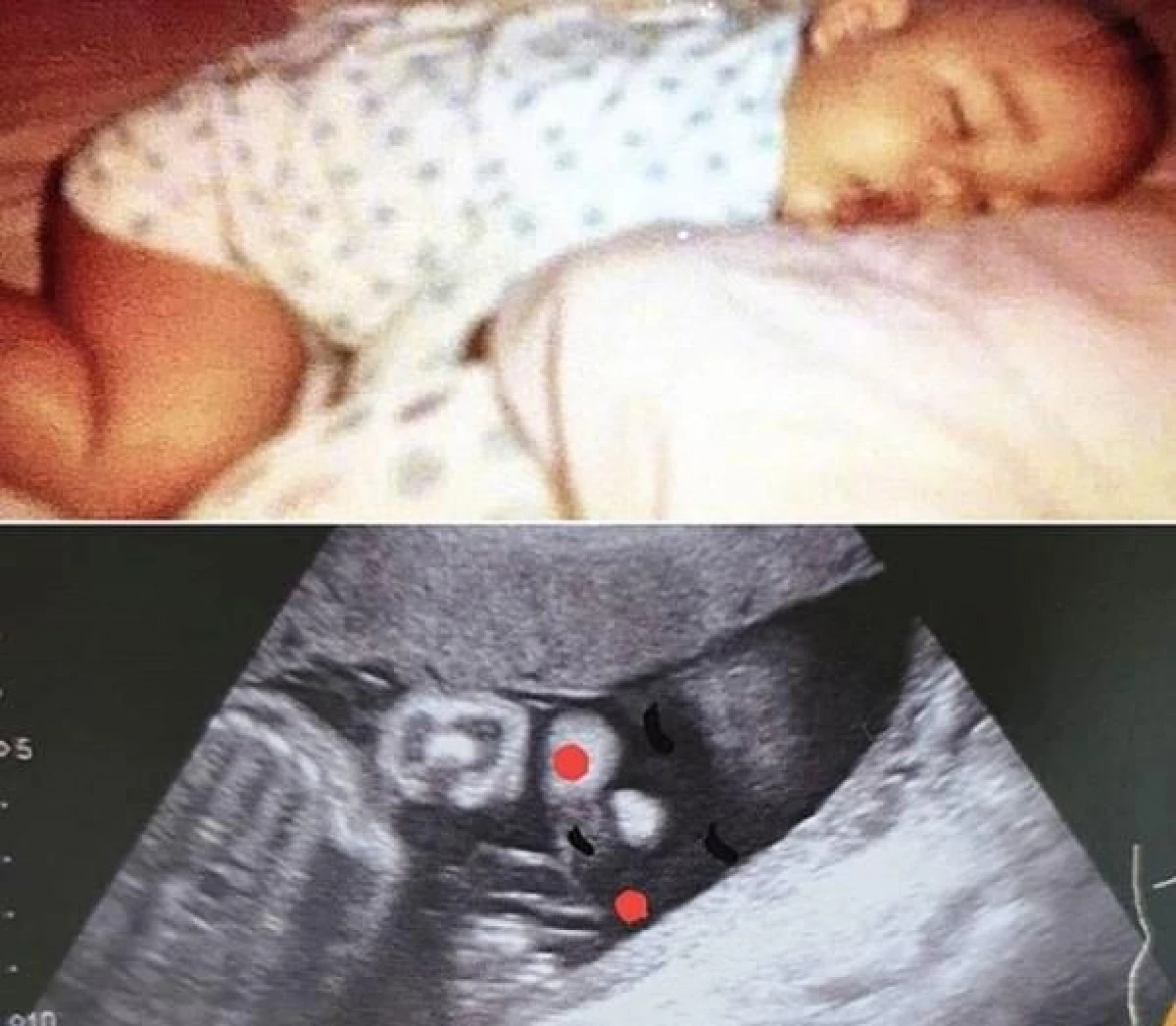 แทค ภรัณยู อวดภาพอัลตราซาวด์ น้องพารัน บอกคนมีรอยสักเลี้ยงลูกเท่จะตาย