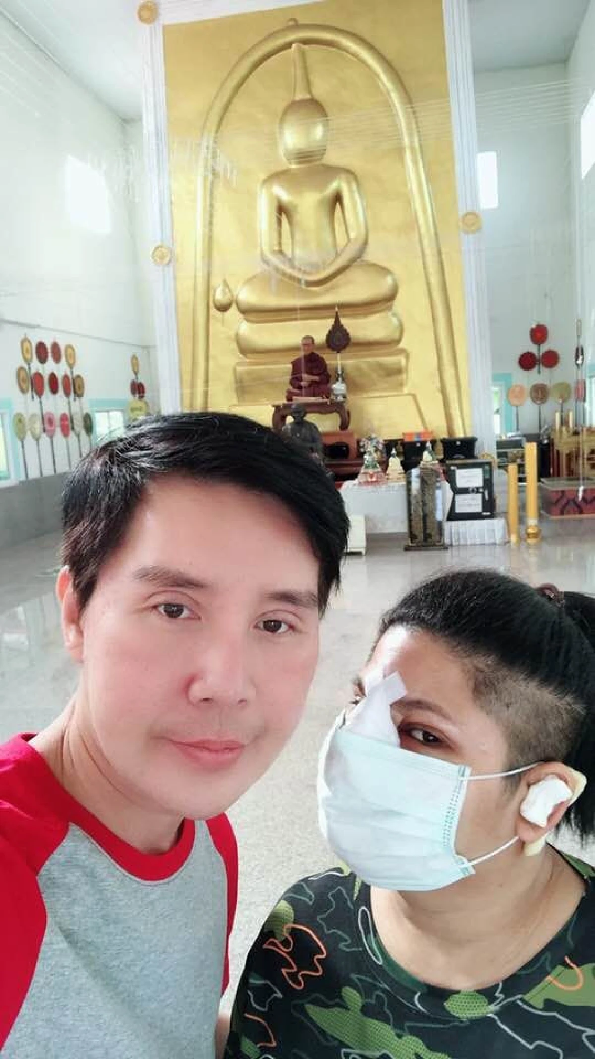 ส่องภาพตลกสาว "เห็ดเผาะ เชิญยิ้ม” หลังทำศัลยกรรมหน้าใหม่ กลายเป็นสาวแซ่บ