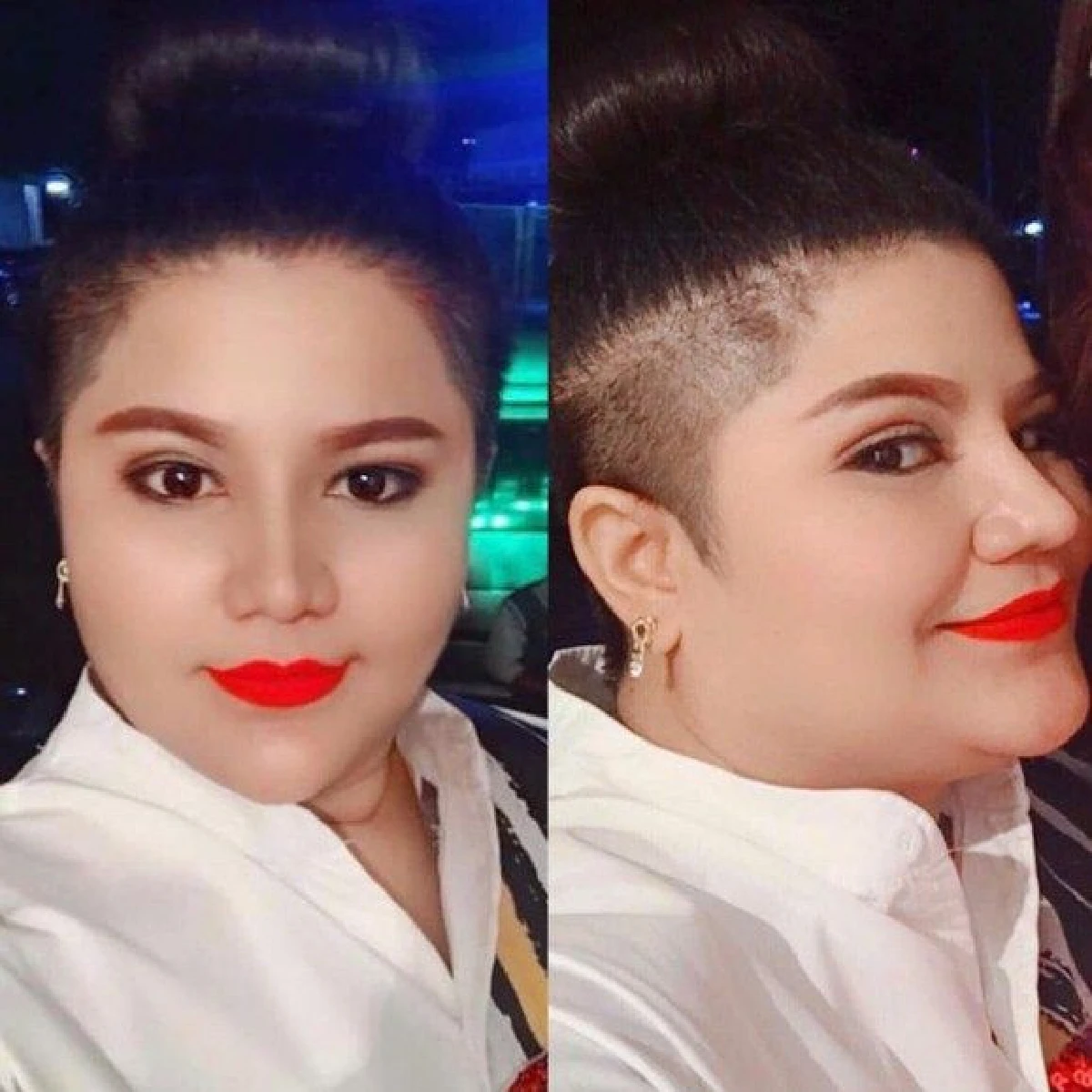 ส่องภาพตลกสาว "เห็ดเผาะ เชิญยิ้ม” หลังทำศัลยกรรมหน้าใหม่ กลายเป็นสาวแซ่บ