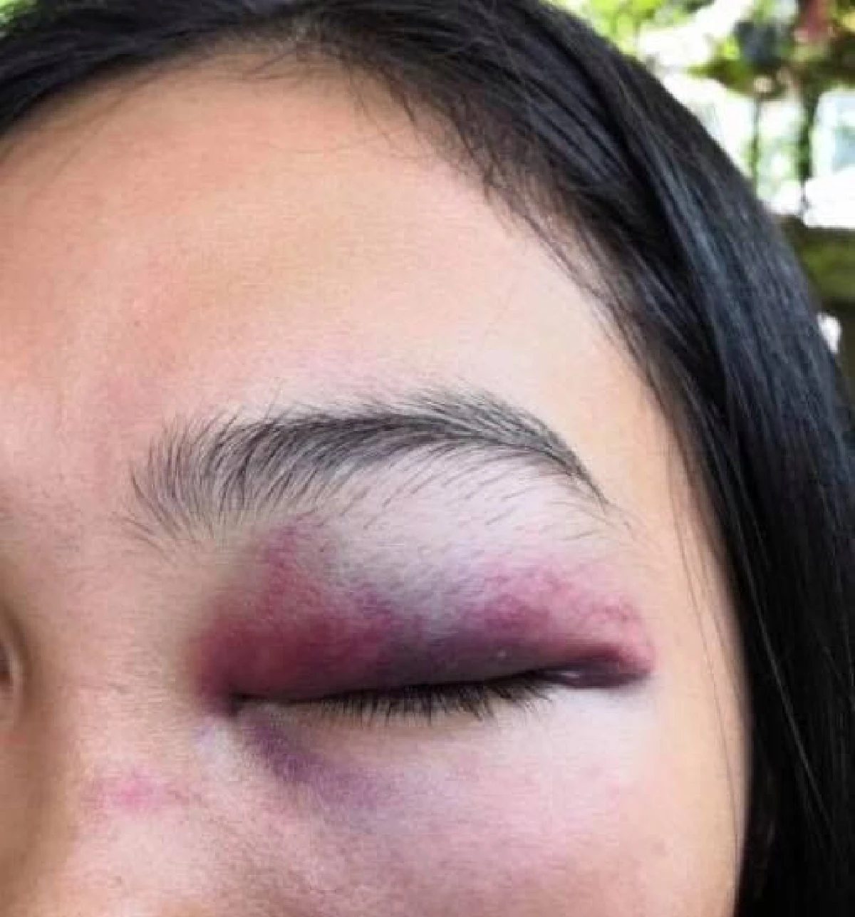 แฟนคลับสาวแจ้งจับ! เบน ชลาทิศ หลังโดนนักร้องดังต่อยจนตาปิด