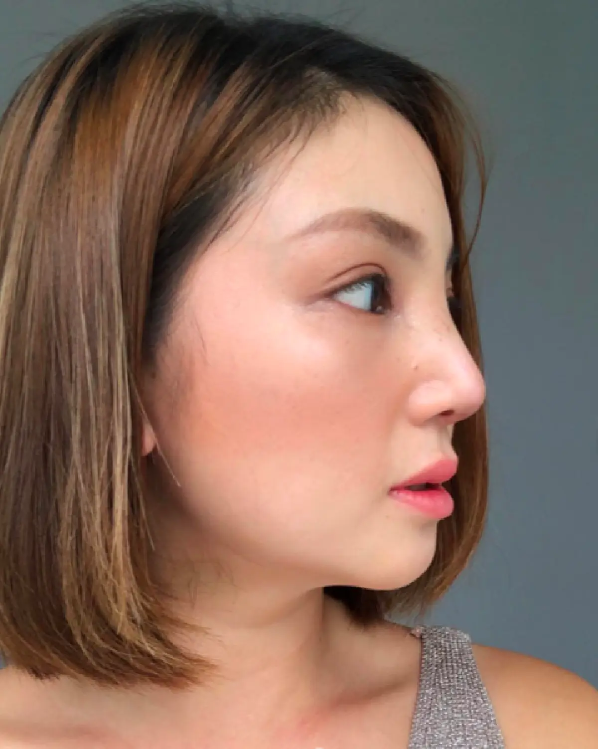 “ฮารุ" อวดโฉมหน้าหลังทำจมูก-ตาใหม่ที่เกาหลี ยังไม่ถึงเดือน แต่ความสวยส่อแววมาแล้ว