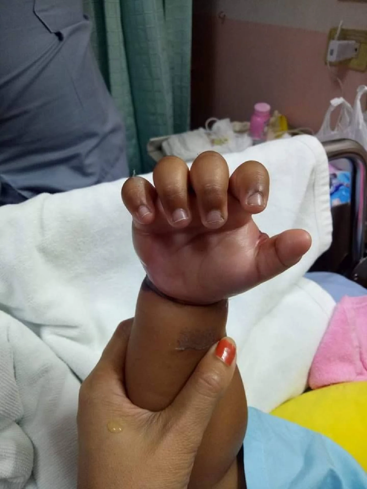 รพ.ธรรมศาสตร์ฯ ขอโทษปมแทงสายน้ำเกลือผู้ป่วยผิดจุด