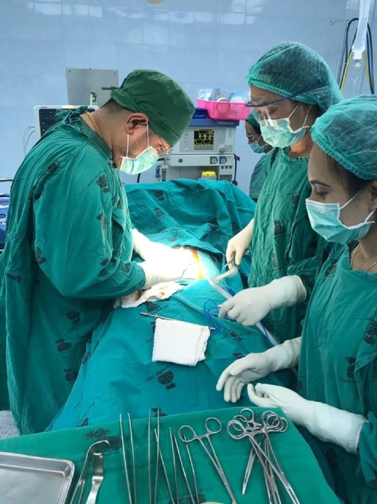 เตือนภัย "สะดือจุ่น" มัจจุราชเงียบทำลำไส้อุดตันถึงตาย