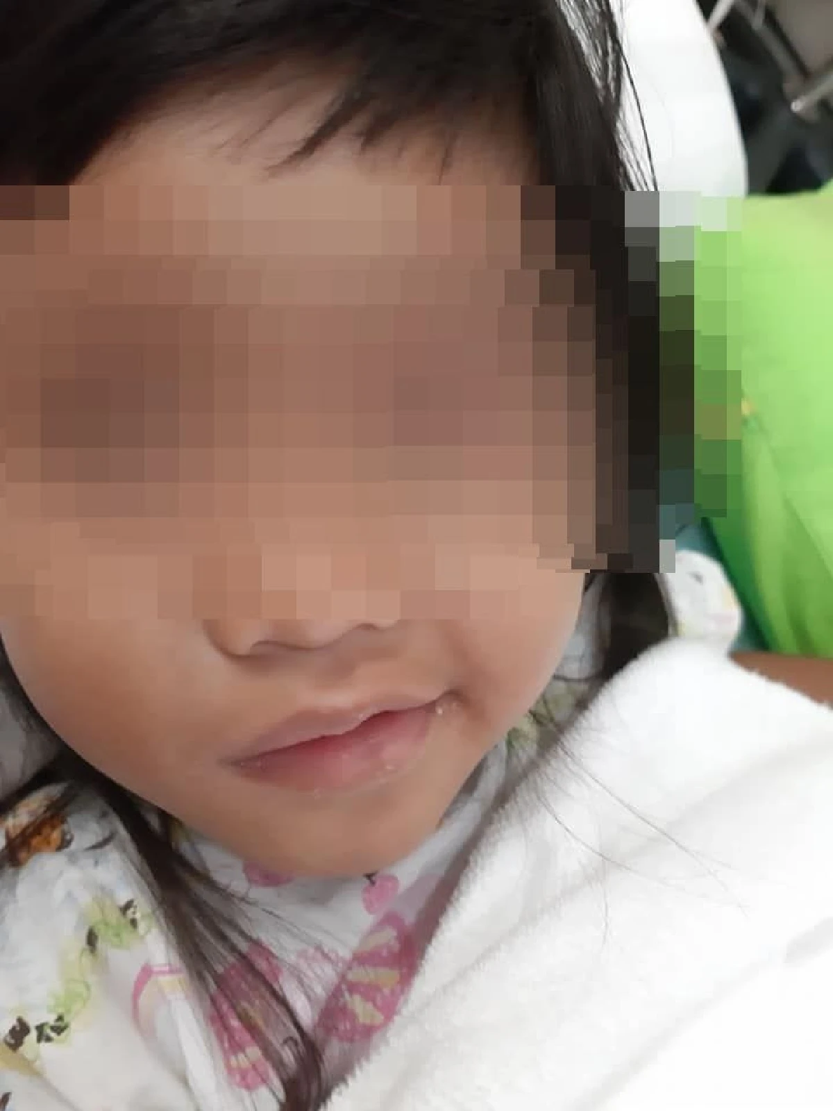 อุทาหรณ์เตือนพ่อแม่! หนูน้อยไวรัสเข้าสมองเพราะเล่นน้ำ