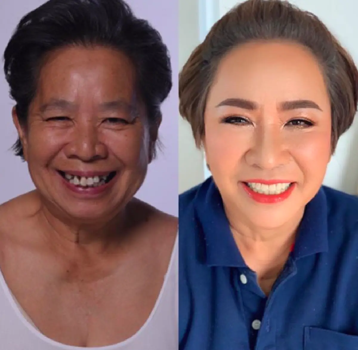 ทำบุญสวยชาติหน้า..ทำหน้าสวยชาตินี้ "บุ๊คโกะ” เผยโฉมหน้า “แม่แมว" หลังใบหน้าเข้าที่แล้ว