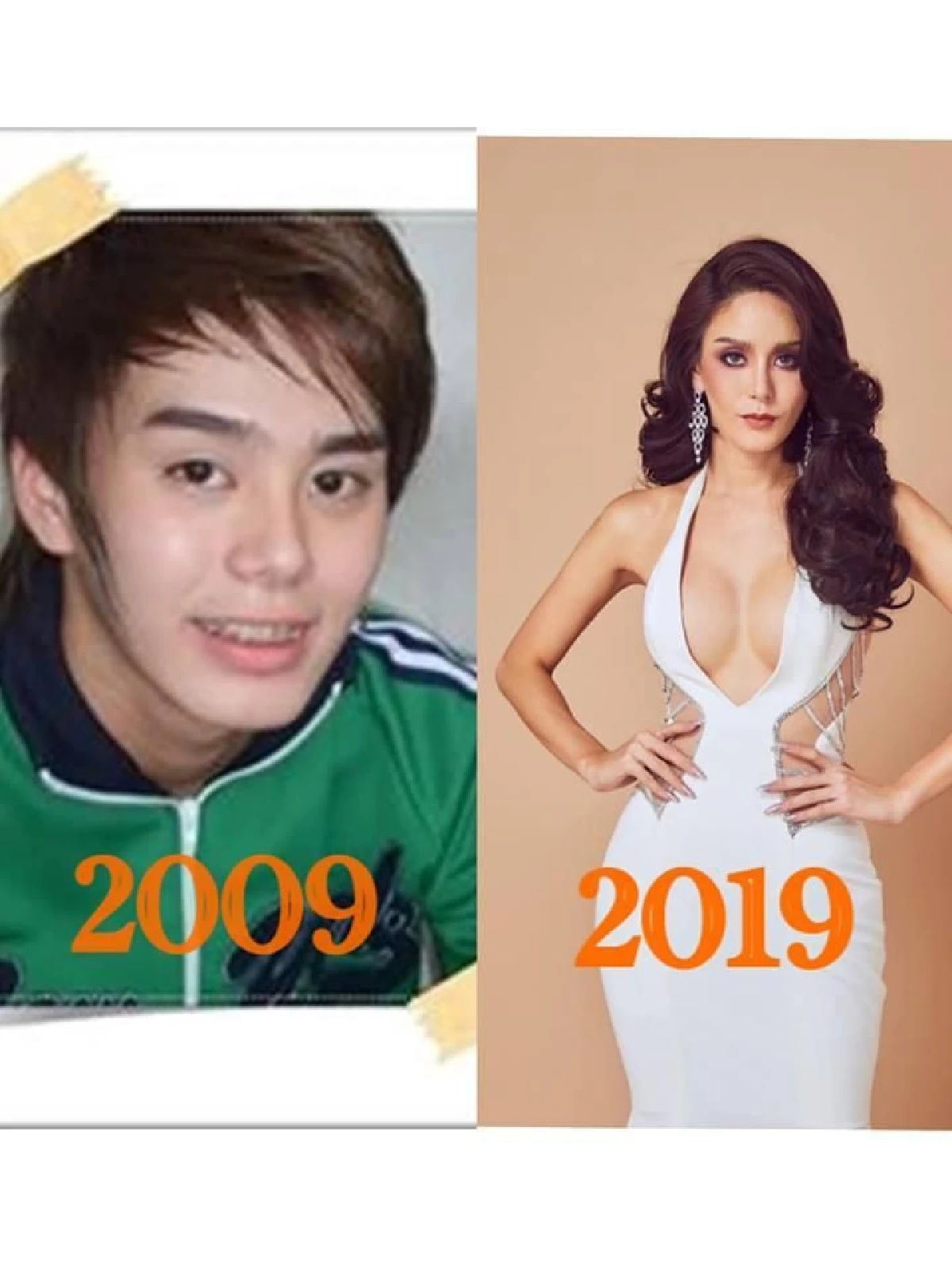 อาร์ม ตรีทิพย์นิภา รองมิสทิฟฟานี่ ผ่าตัดเอาหน้าอกออกขอเป็น unisex