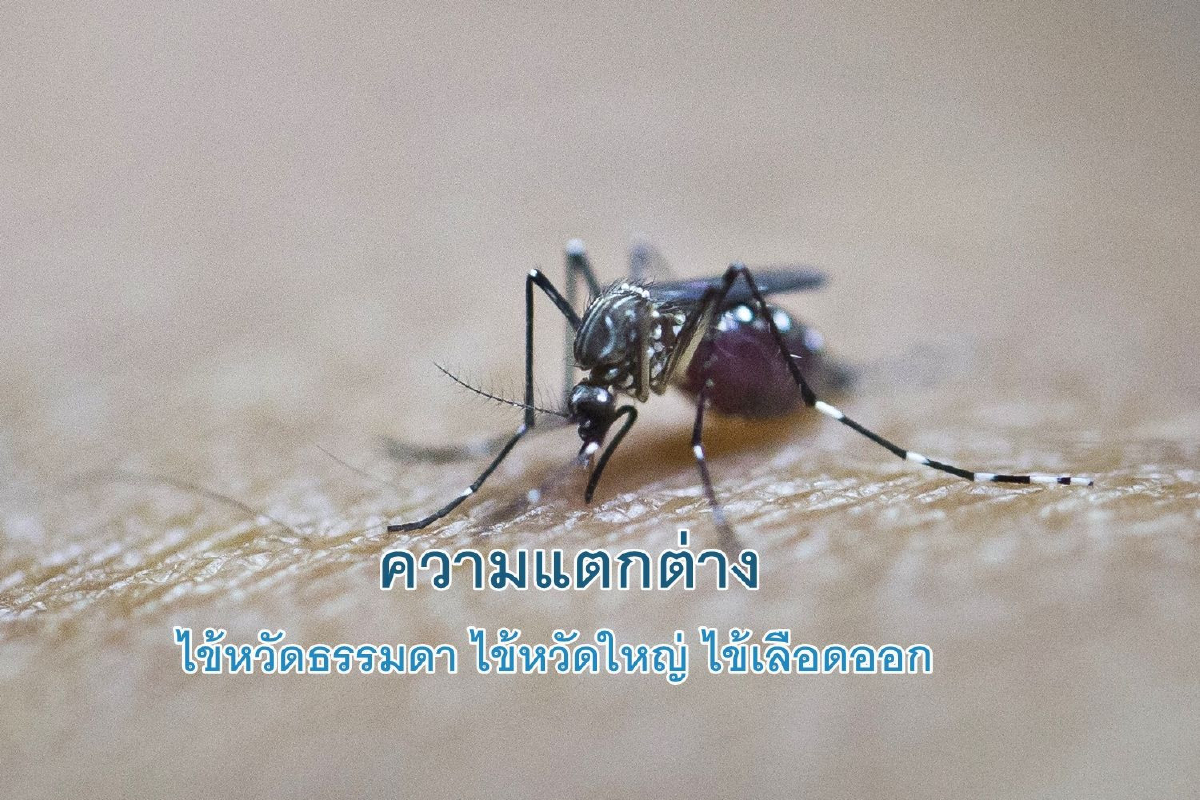 ความแตกต่างของไข้หวัดธรรมดา ไข้หวัดใหญ่ และไข้เลือดออก ความแตกต่างของไข้หวัดธรรมดา ไข้หวัดใหญ่ และไข้เลือดออก