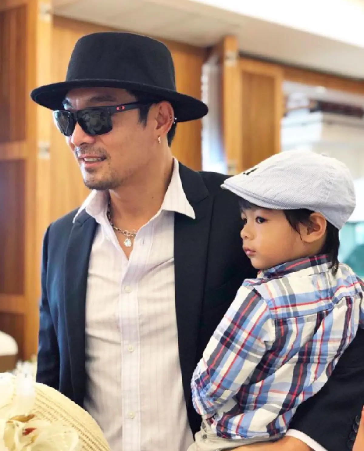 "น้องโอลาฟ" ตกจากที่สูง 2 เมตร ตาบวมม่วงจนปิด "จีน่า-โอ๊ต" เผยเหตุจากความซน