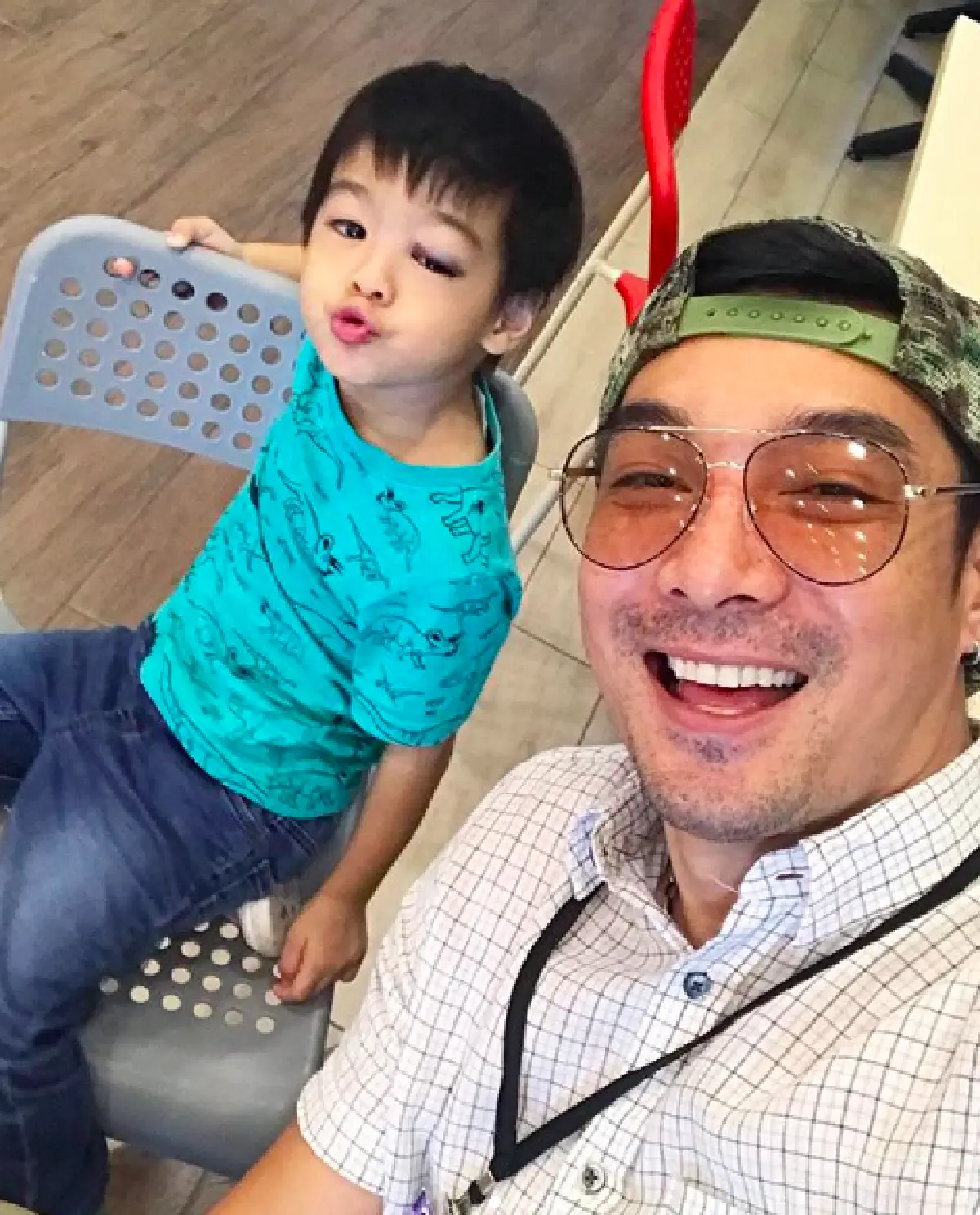 "น้องโอลาฟ" ตกจากที่สูง 2 เมตร ตาบวมม่วงจนปิด "จีน่า-โอ๊ต" เผยเหตุจากความซน