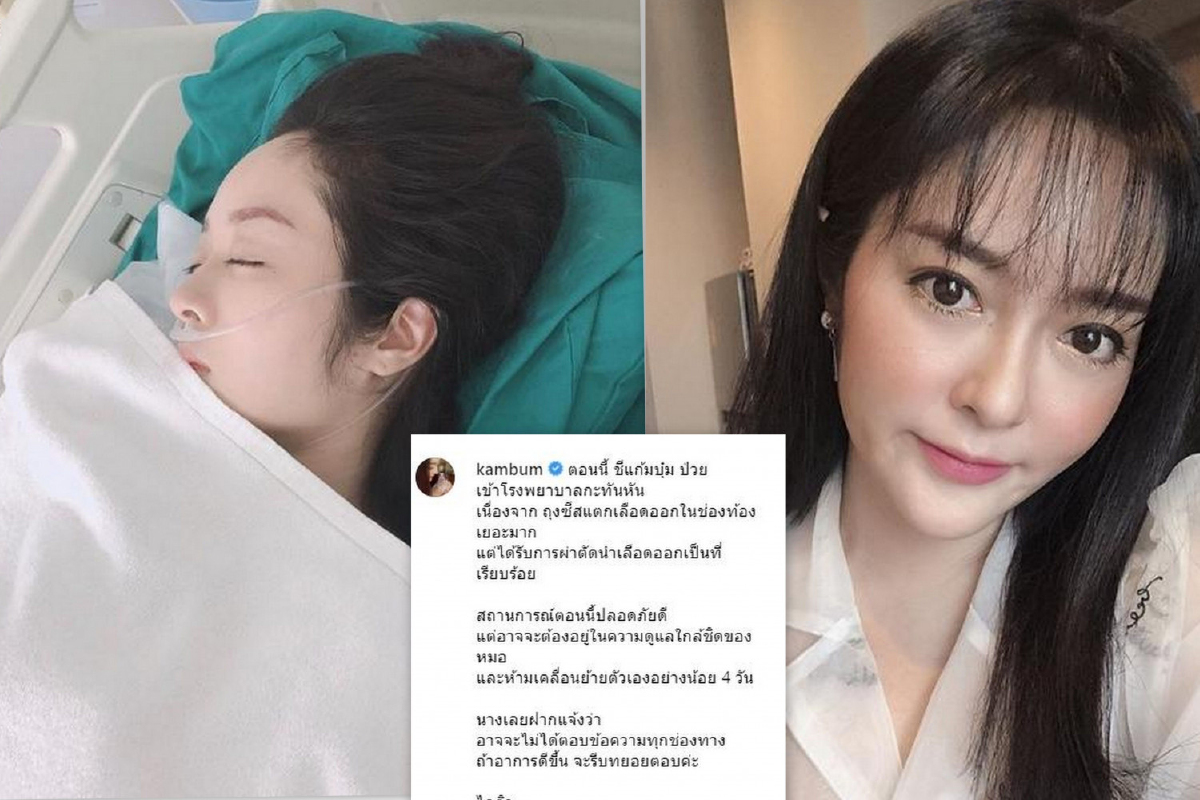ปลอดภัยแล้ว! แก้มบุ๋ม ปรียาดา ถูกหามส่งรพ. ถุงซีสต์แตกเลือดออกในช่องท้อง ปลอดภัยแล้ว! แก้มบุ๋ม ปรียาดา ถูกหามส่งรพ. ถุงซีสต์แตกเลือดออกในช่องท้อง
