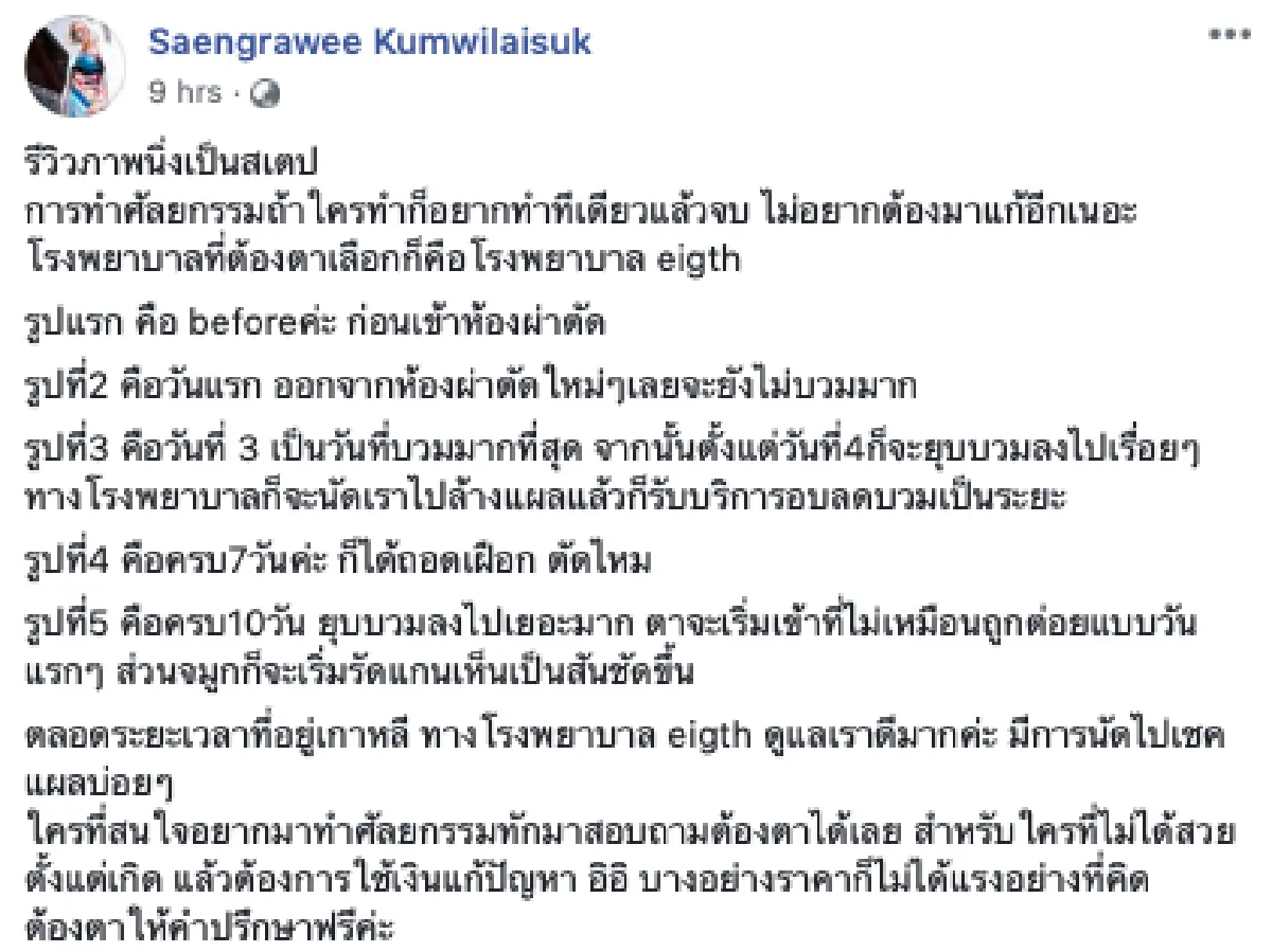 ส่องภาพสุดแซ่บ "ต้องตา แสงรวี" น้องสาว “โตโน่” หลังบินไปศัลยกรรมที่เกาหลี