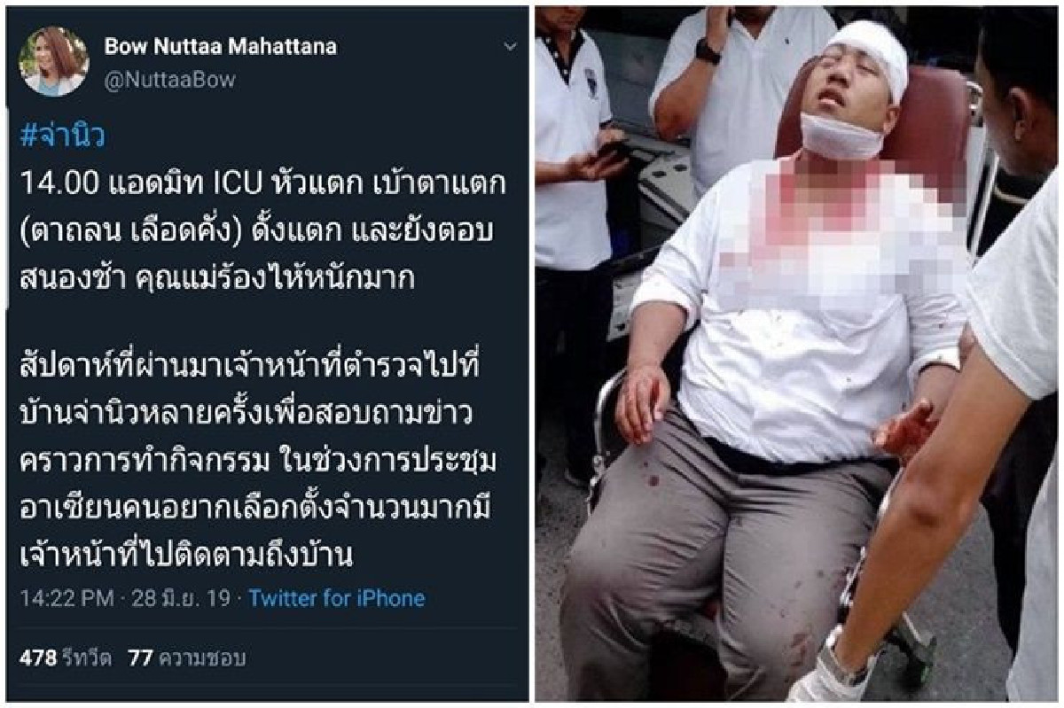อาการ"จ่านิว"ยังหนัก แอดมิทไอซียู เบ้าตาแตก ตอบสนองช้า อาการ"จ่านิว"ยังหนัก แอดมิทไอซียู เบ้าตาแตก ตอบสนองช้า
