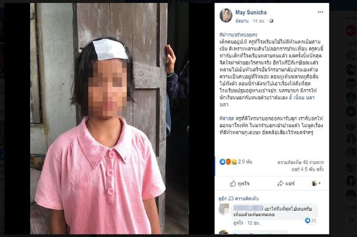 ครูลงโทษโหดไม้ตีเด็กป.6หัวแตกเย็บ3เข็มเพราะลอกการบ้านเพื่อน ครูลงโทษโหดไม้ตีเด็กป.6หัวแตกเย็บ3เข็มเพราะลอกการบ้านเพื่อน