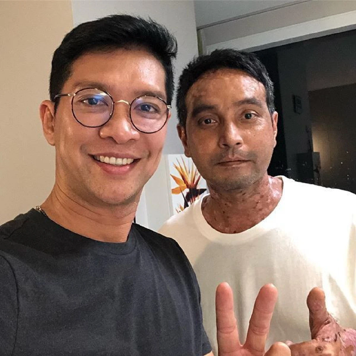 หนุ่ม คงกะพัน ช่วยทำแผลทายาให้ วินัย ไกรบุตร พร้อมอัปเดตอาการป่วย