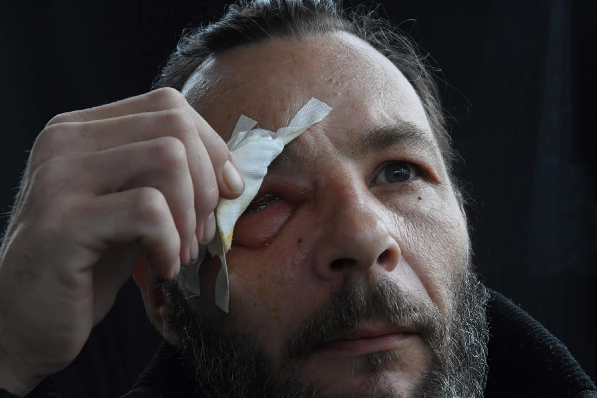 การประท้วงที่มีคนตาบอดมากที่สุด ผลพวงที่ไม่มีใครรู้ของม็อบเสื้อกั๊กเหลือง