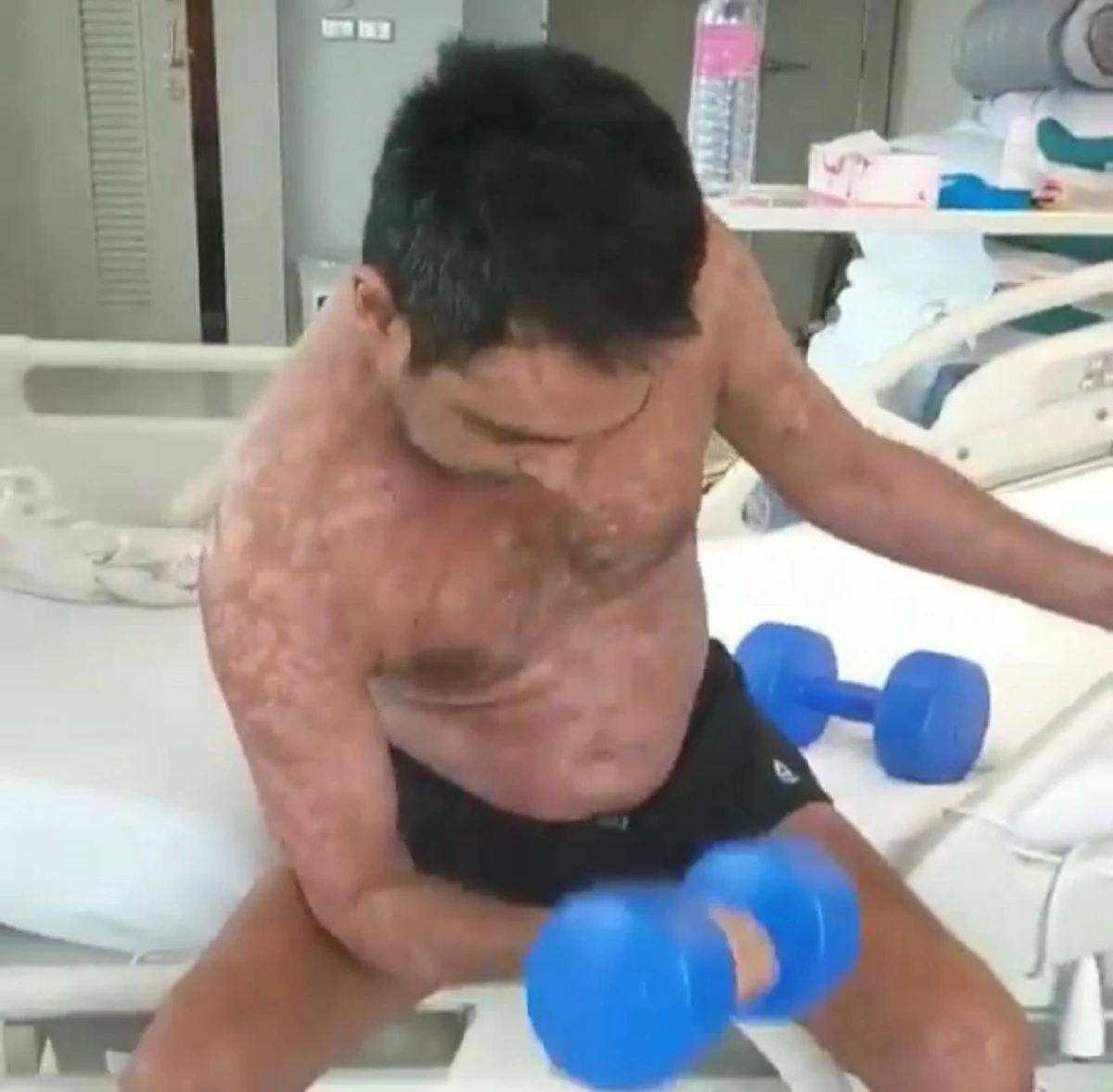 วินัย ไกรบุตร กลับมาฟิตยกเวทที่รพ. หวั่นนอนนานๆขาแขนลีบ