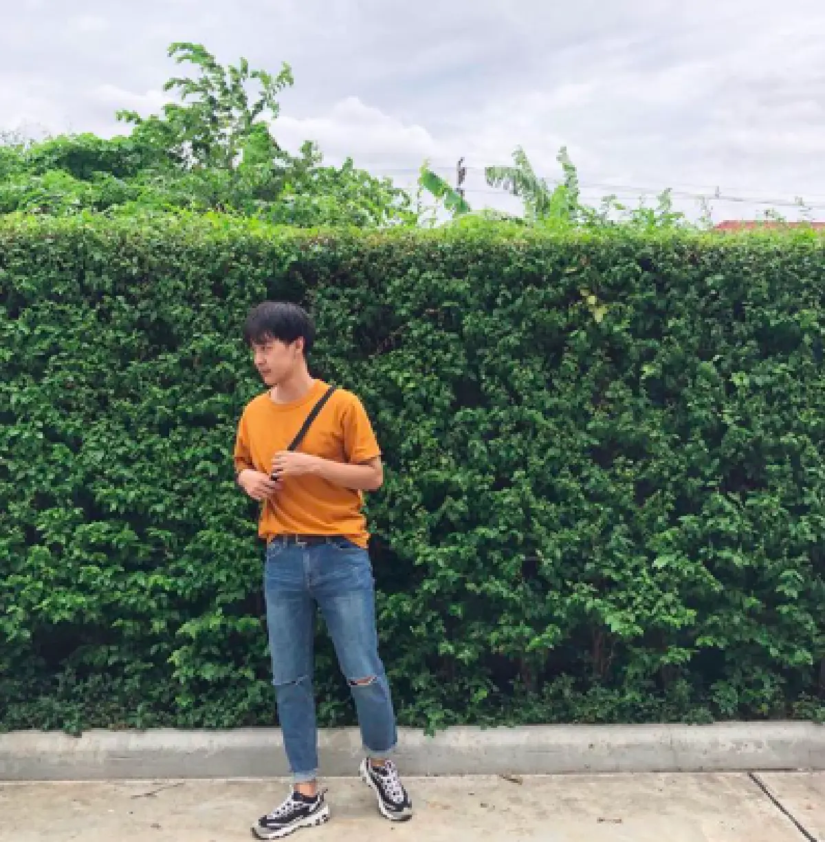 "หม่อมเอ็ม” เผยภาพก่อน-หลัง ให้เห็นชัดๆ หลังศัลยกรรมกระดูกขากรรไกร