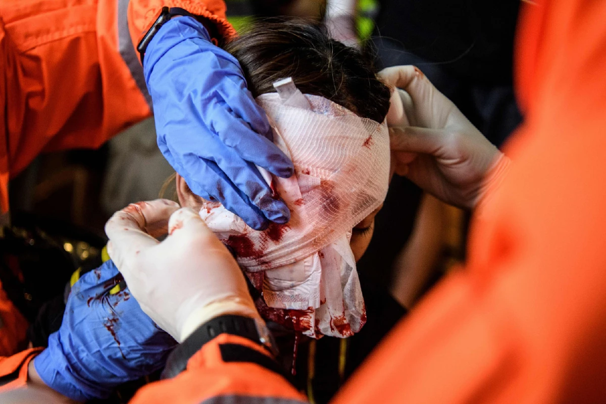 หญิงฮ่องกงตาแตก อาจถูกม็อบด้วยกันเองยิงใส่