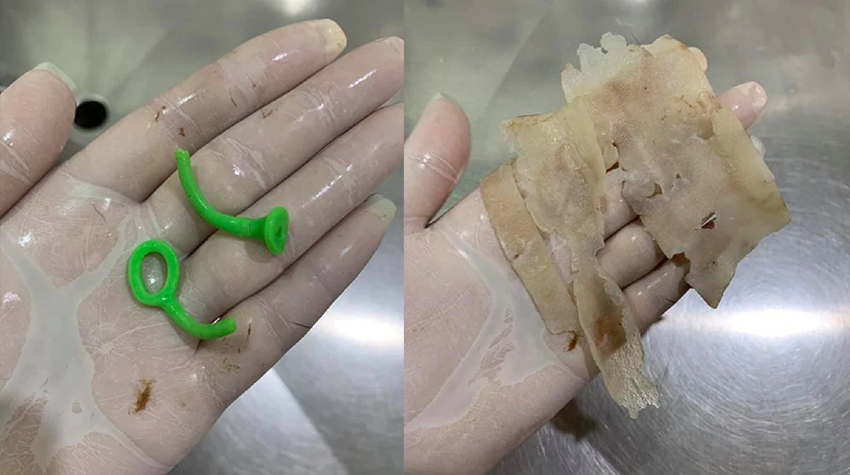 ผงะ! ผ่าตัดพุงน้องหมาเจอตุ๊กตาเป็ดอยู่ในท้อง 32 ตัว