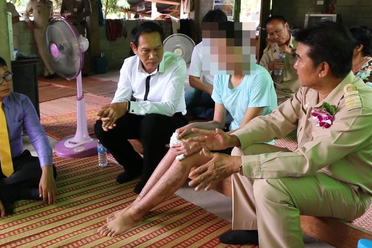 สั่งตั้งกรรมการสอบแล้ว! เหตุสาวม.6ถูกไฟคลอกขณะทำโครงงานส่งแก้ผลสอบ สั่งตั้งกรรมการสอบแล้ว! เหตุสาวม.6ถูกไฟคลอกขณะทำโครงงานส่งแก้ผลสอบ