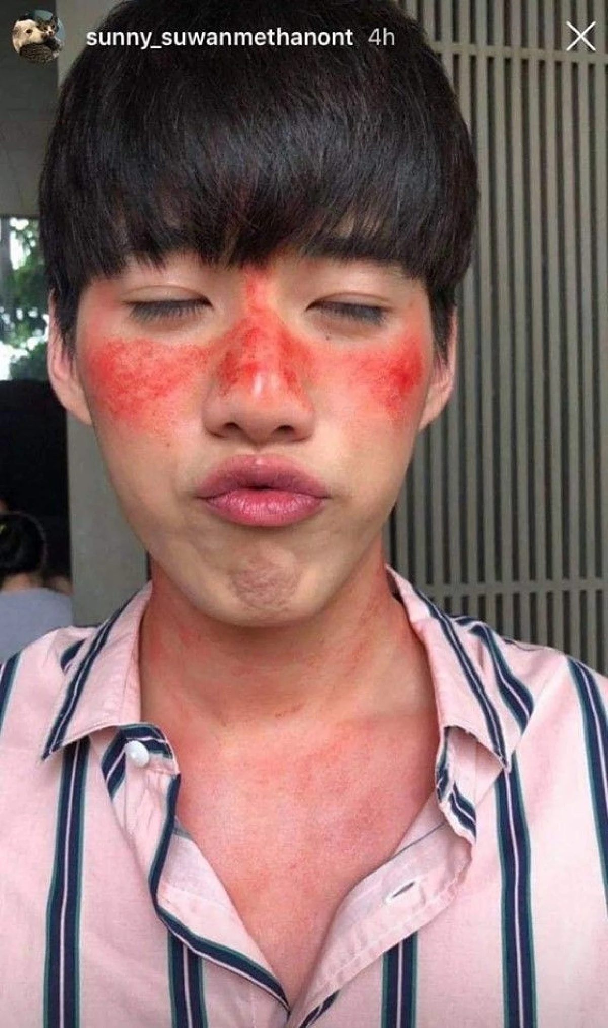 เราควรต้องพักเศร้า! “ซันนี่” โพสต์ภาพหลุดสุดฮา ของเหล่านักแสดง "รักฉุดใจนายฉุกเฉิน”