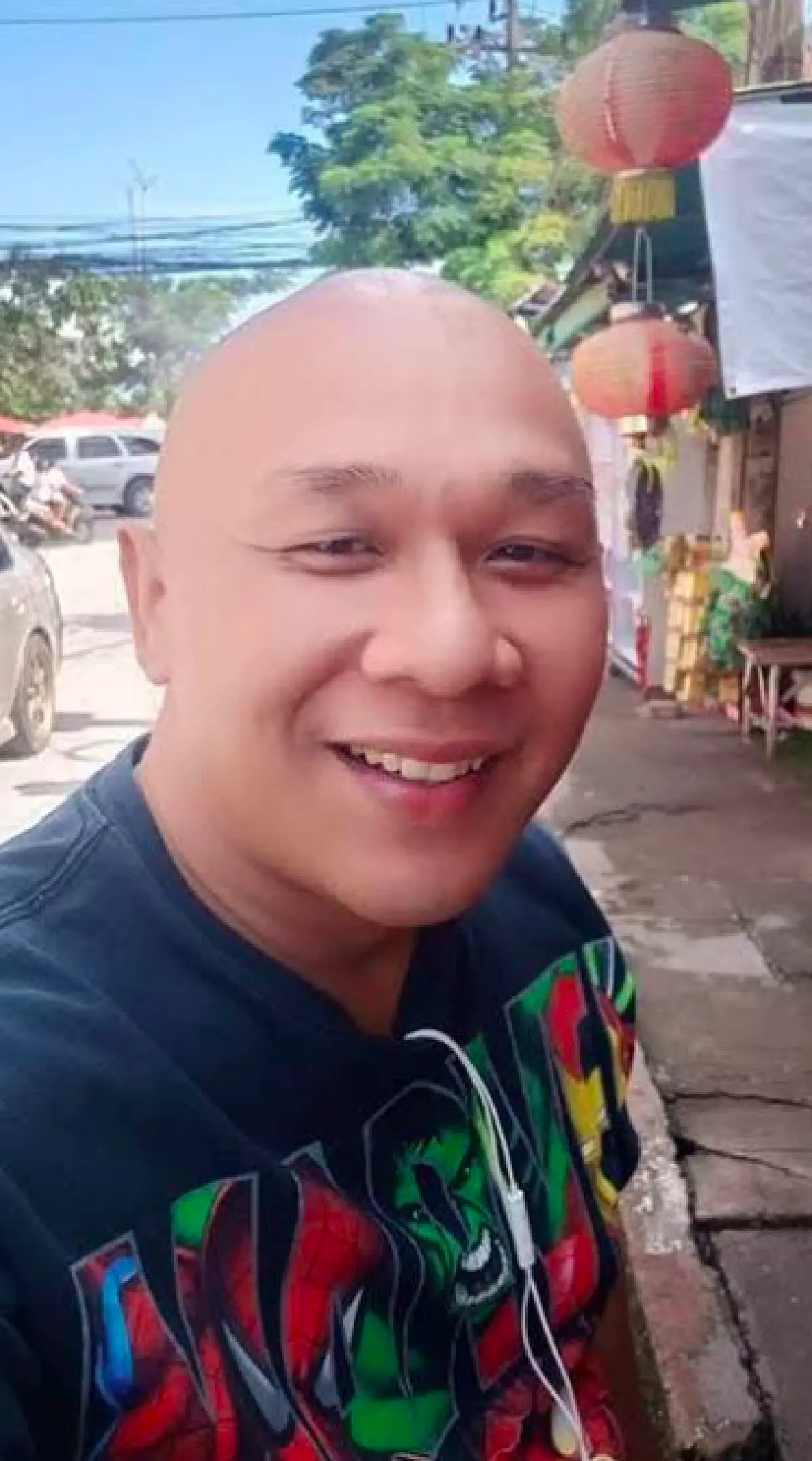 "โหน่งน้อย เอ็นจอยโชว์” เสียชีวิตแล้ว! หลังป่วยหนักด้วยอาการป่วยตับแข็ง