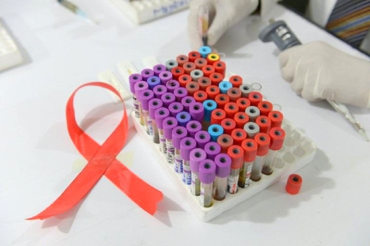 นักวิทย์พบเชื้อ HIV สายพันธุ์ใหม่ นักวิทย์พบเชื้อ HIV สายพันธุ์ใหม่