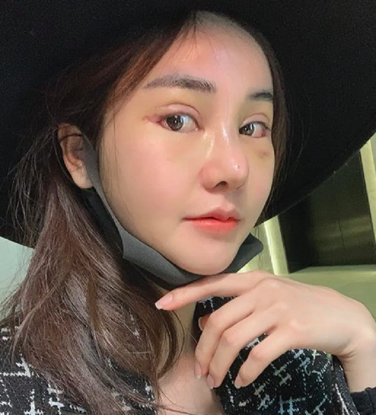 “บลู จิรารัตน์” บินอัพเกรดความสวยที่เกาหลี จัดเต็มแปลงโฉมหน้าใหม่ราคา 7 หลัก