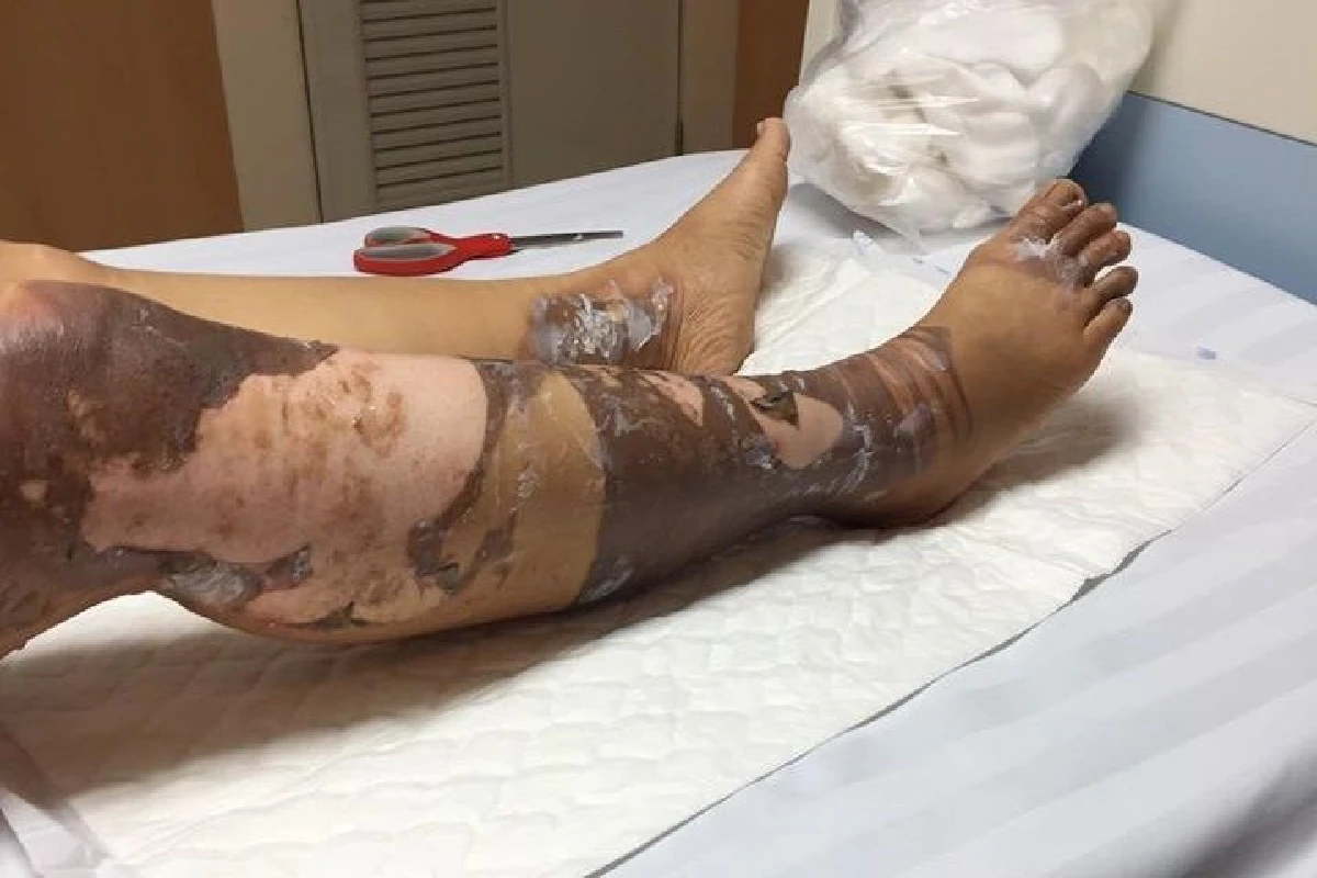 ฮีโร่ตัวจริง! หนุ่มวินมอไซต์ช่วยสาวถูกสายไฟฟ้าแรงสูงช็อตรอดตาย