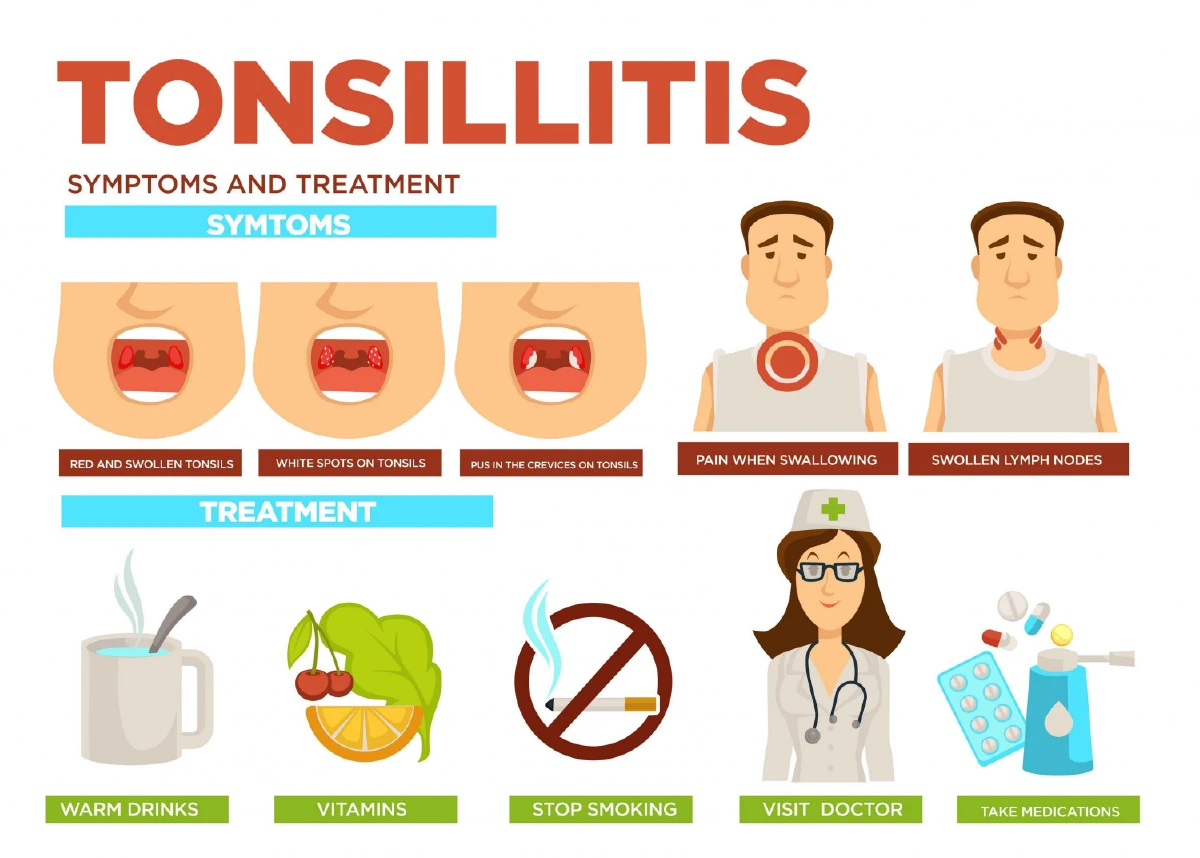 ทอนซิลอักเสบ อาการป่วยที่มาพร้อมอากาศเปลี่ยน