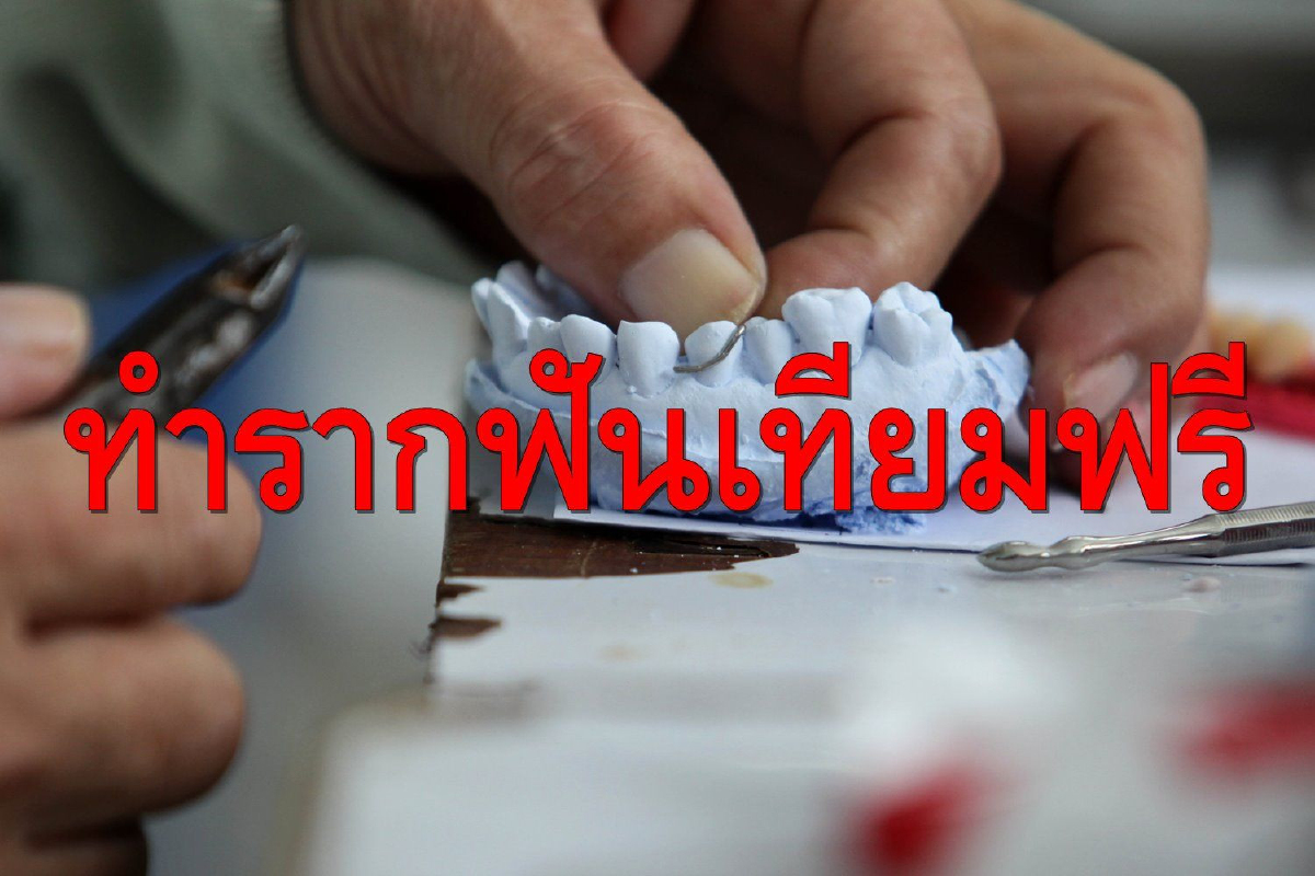 ครม.แจกของขวัญปีใหม่ให้คนจนทำรากฟันเทียมฟรี ครม.แจกของขวัญปีใหม่ให้คนจนทำรากฟันเทียมฟรี